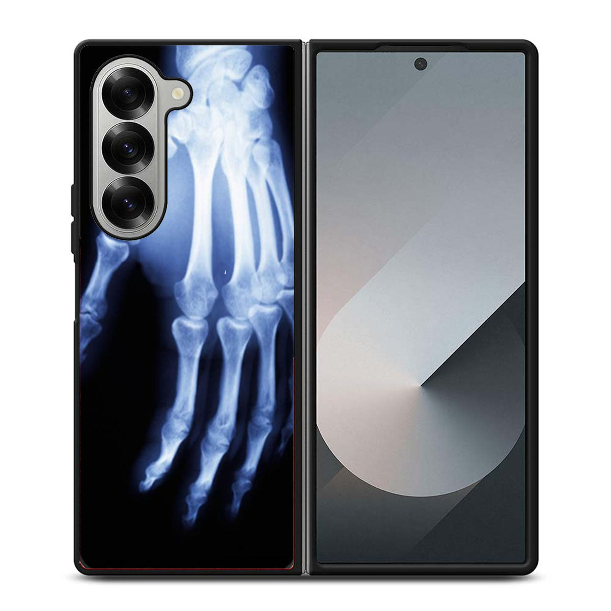 Hand X Ray Samsung Z Fold 6 Case