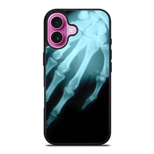 Hand XRay iPhone Case Cover