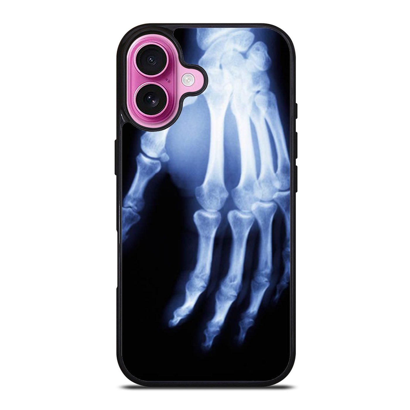Hand X Ray iPhone Case Cover