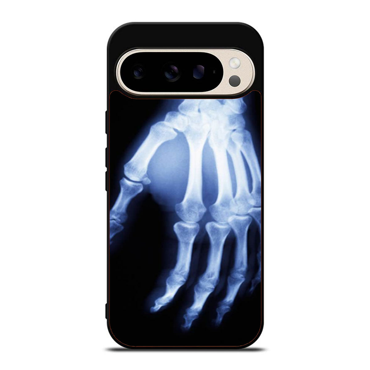 Hand X Ray Google Pixel 9 Pro Case