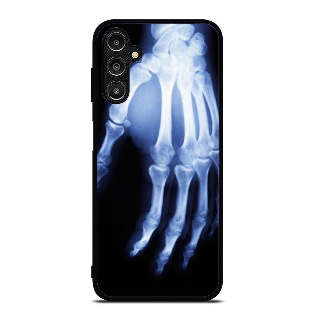Hand X Ray Samsung A16 Case