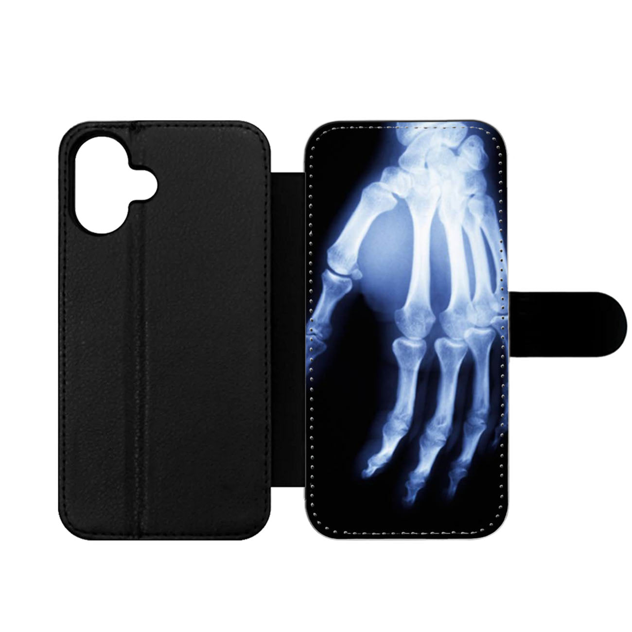 Hand X Ray Wallet iPhone Case