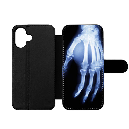 Hand X Ray Wallet iPhone Case