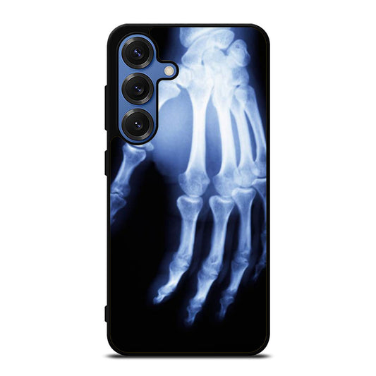 Hand X Ray Samsung S25 Ultra Case